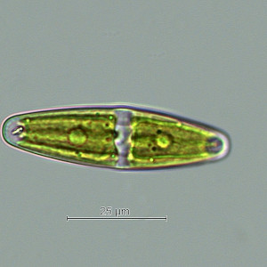 Closterium navicula