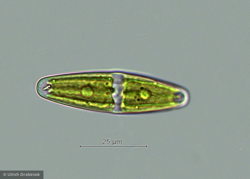 Chlorophyta Conjugatophyceae Desmidiales Closterium navicula