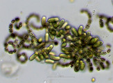 Cyanobacteria Cyanobacteria Nostocales Dolichospermum lemmermannii