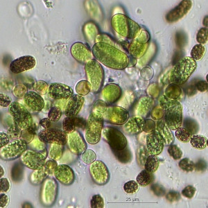 Dolichospermum lemmermannii