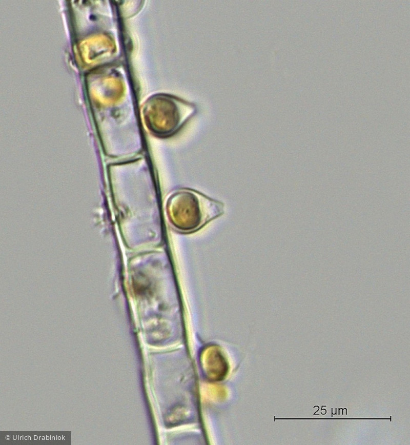 Heterocontophyta Chrysophyceae Stylococcales Chrysopyxis sp.