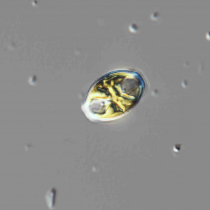 Amphora ovalis