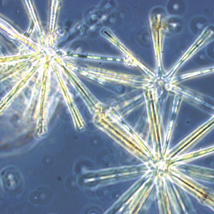 Asterionella formosa