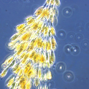 Dinobryon divergens