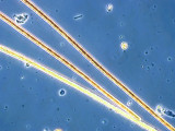 Cyanobacteria Cyanobacteria Oscillatoriales Planktothrix rubescens