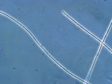 Cyanobacteria Cyanobacteria Oscillatoriales Limnothrix redekei