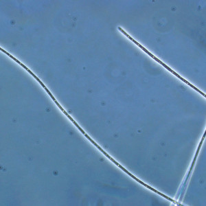 Limnothrix redekei