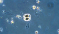 Chlorophyta Conjugatophyceae Desmidiales Cosmarium depressum var. planctonicum