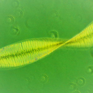 Fragilaria crotonensis