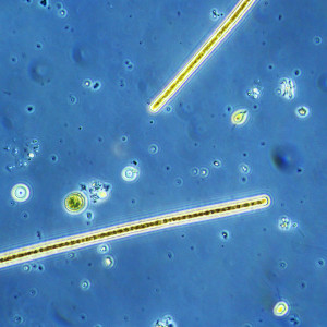 Planktothrix rubescens
