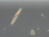 Chlorophyta Ulvophyceae Ulotrichales Elakatothrix gelatinosa