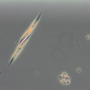 Elakatothrix gelatinosa