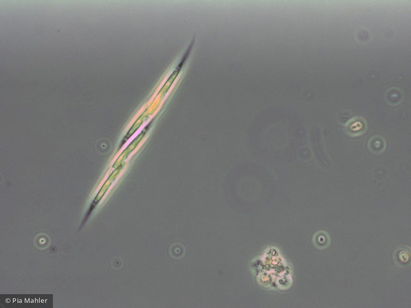 Chlorophyta Ulvophyceae Ulotrichales Elakatothrix gelatinosa