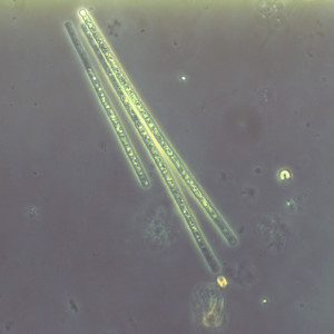 Aphanizomenon flos-aquae