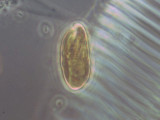 Cryptophyceae Cryptophyceae Cryptomonadales Cryptomonas erosa/ovata/phaseolus