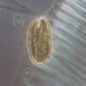 Cryptomonas erosa/ovata/phaseolus