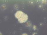 Cyanobacteria Cyanobacteria Chroococcales Woronichinia naegeliana