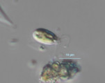 Mallomonas schwemmlei · Heterocontophyta Chrysophyceae Ochromonadales