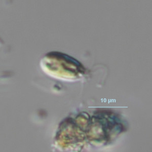 Mallomonas schwemmlei