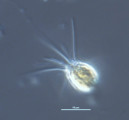 Mallomonas tonsurata · Heterocontophyta Chrysophyceae Ochromonadales
