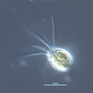 Mallomonas tonsurata