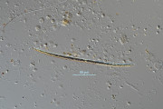 Closterium juncidum · Chlorophyta Conjugatophyceae Desmidiales