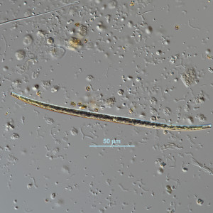 Closterium juncidum