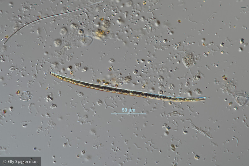 Closterium juncidum · Chlorophyta Conjugatophyceae Desmidiales