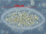 Cymatopleura elliptica · Heterocontophyta Bacillariophyceae Pennales · 100x
