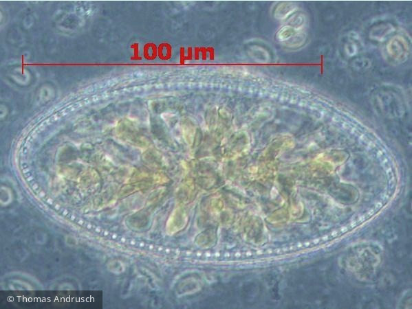 Cymatopleura elliptica · Heterocontophyta Bacillariophyceae Pennales · 100x