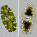 Euastrum oblongum &middot; Chlorophyta Conjugatophyceae Desmidiales