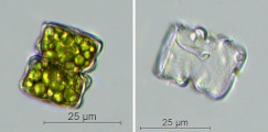 Cosmarium obliquum · Chlorophyta Conjugatophyceae Desmidiales