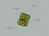 Cosmarium obliquum · Chlorophyta Conjugatophyceae Desmidiales