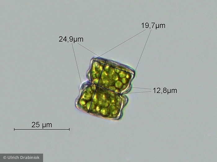 Cosmarium obliquum · Chlorophyta Conjugatophyceae Desmidiales