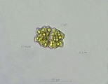 Euastrum neogutwinskii · Chlorophyta Conjugatophyceae Desmidiales