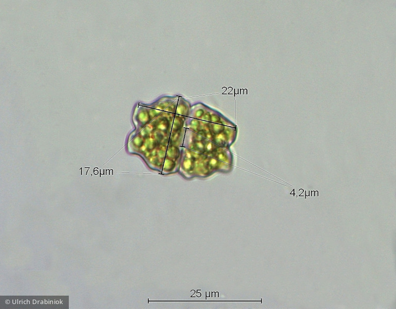Euastrum neogutwinskii · Chlorophyta Conjugatophyceae Desmidiales