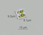 Teilingia granulata &middot; Chlorophyta Conjugatophyceae Desmidiales