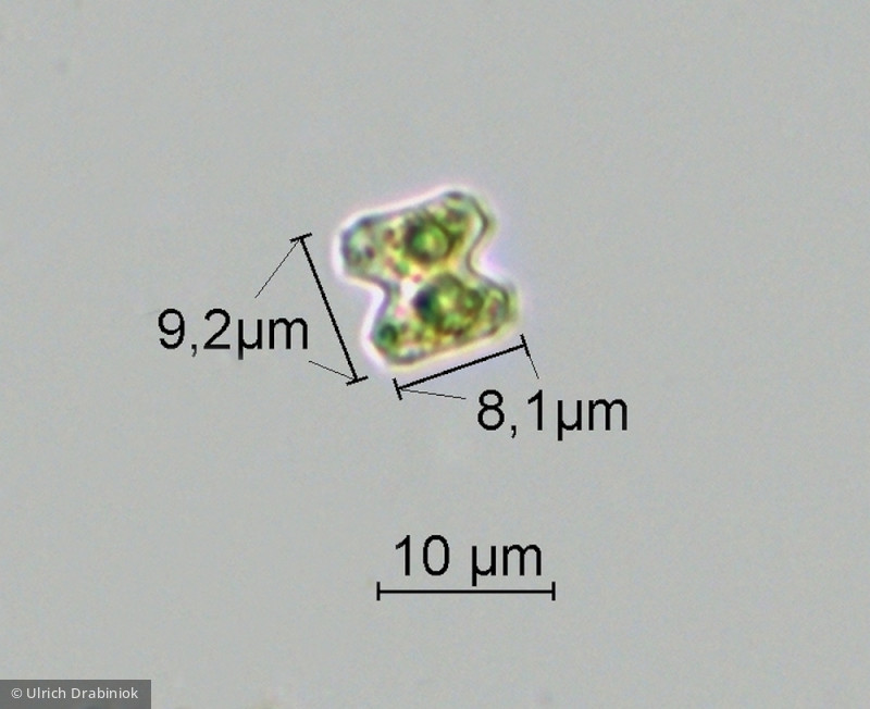 Teilingia granulata &middot; Chlorophyta Conjugatophyceae Desmidiales