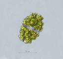 Euastrum bidentatum &middot; Chlorophyta Conjugatophyceae Desmidiales