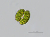 Cosmarium depressum &middot; Chlorophyta Conjugatophyceae Desmidiales